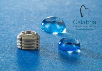 Lamezia, Chirurgia Implantare Dentale: la rivoluzione degli Impianti minimante invasivi tra i più piccoli al mondo brevettata dal dottor Ennio Calabria